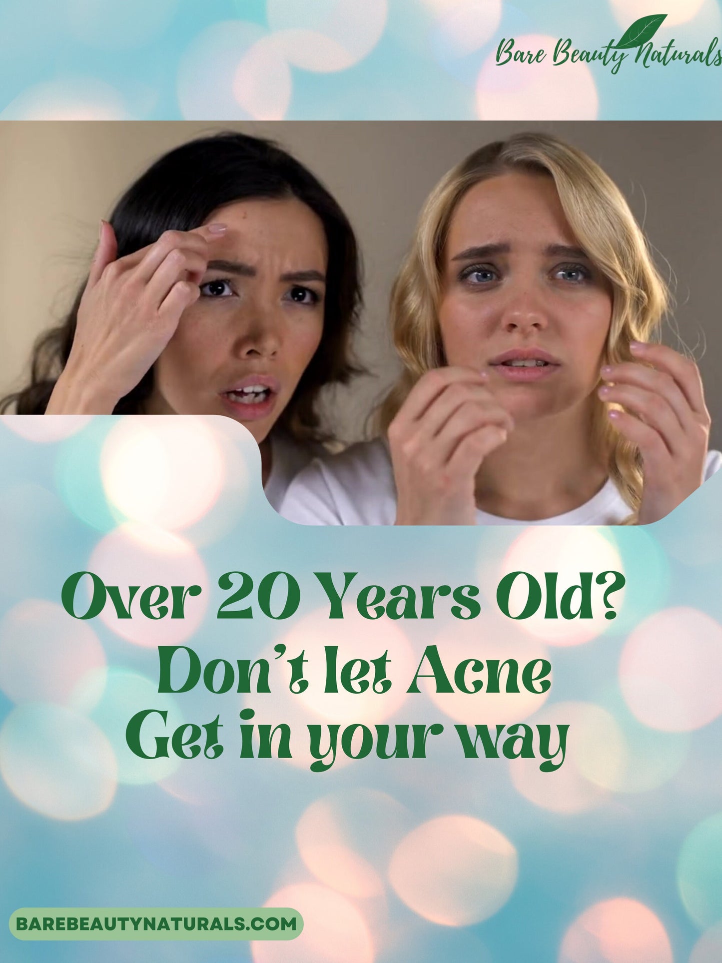 100% Natural Acne after 20 (Aa20) soap // Free Exfoliating Soap Bag